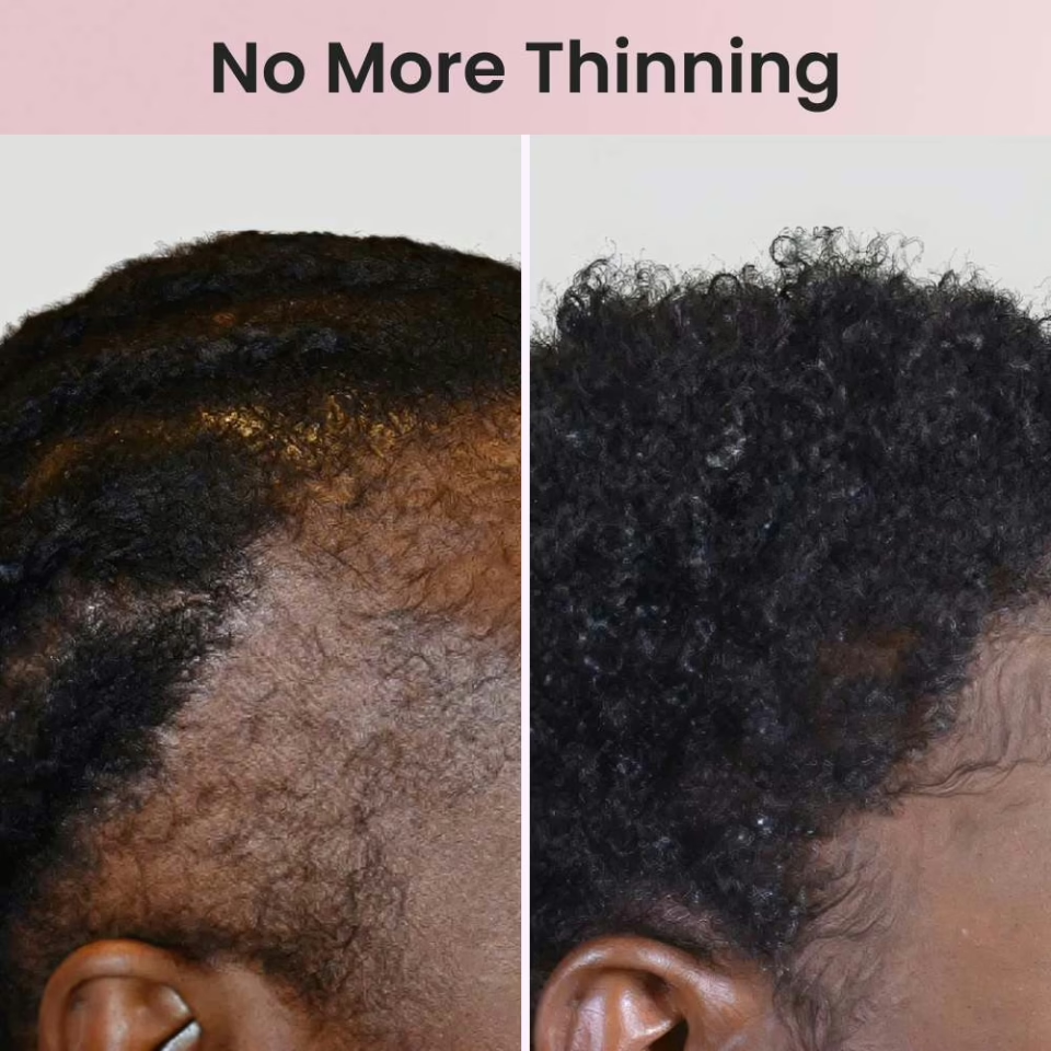 💥 LAST DAY 50% OFF✨Deep Soothing Electric Hair Oil Applicator with Scalp Massage