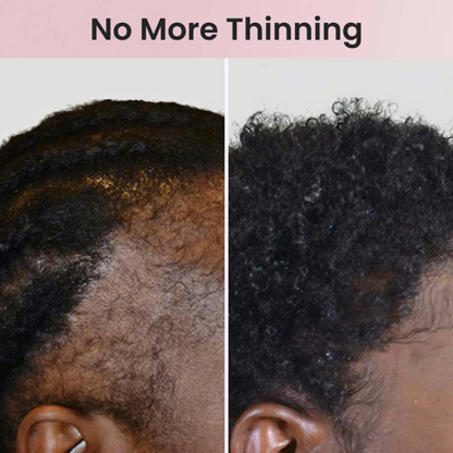 💥 LAST DAY 50% OFF✨Deep Soothing Electric Hair Oil Applicator with Scalp Massage